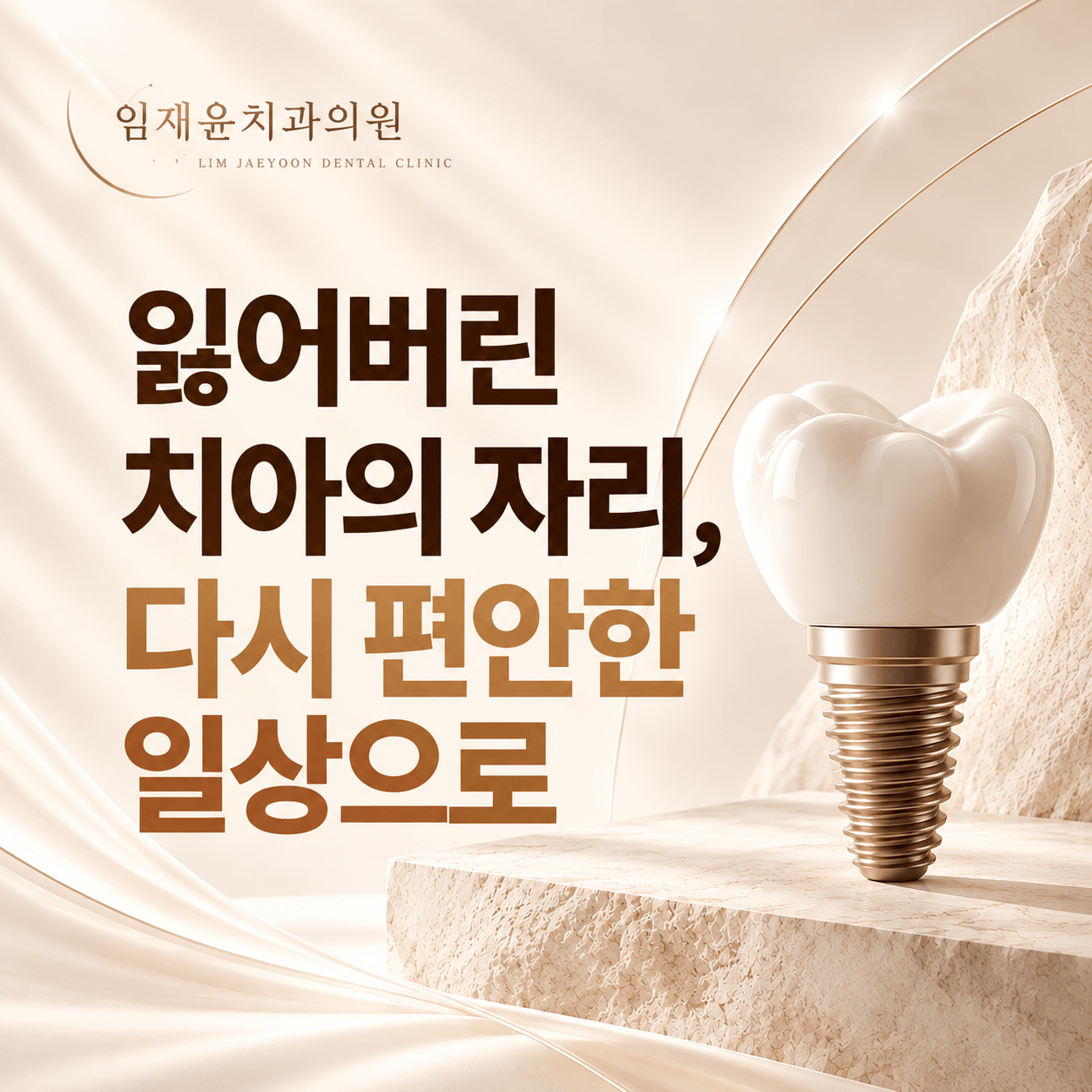 임플란트