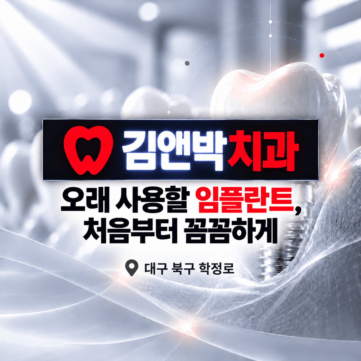 임플란트