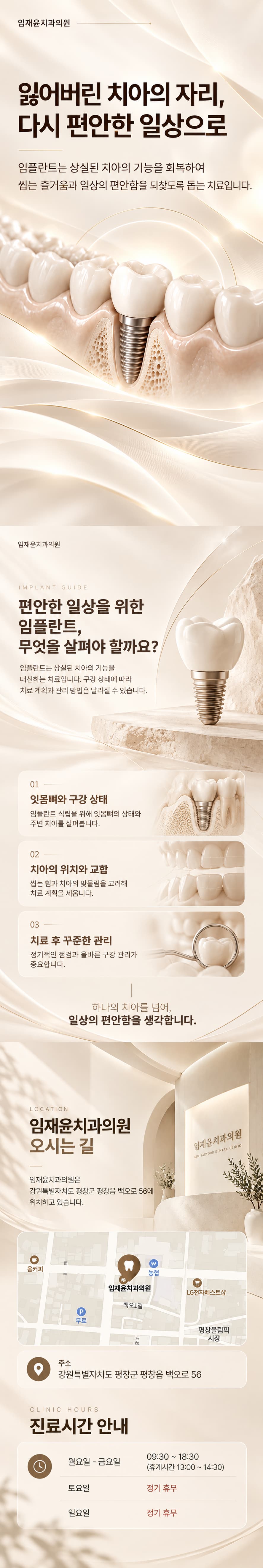 임플란트 상세 이미지