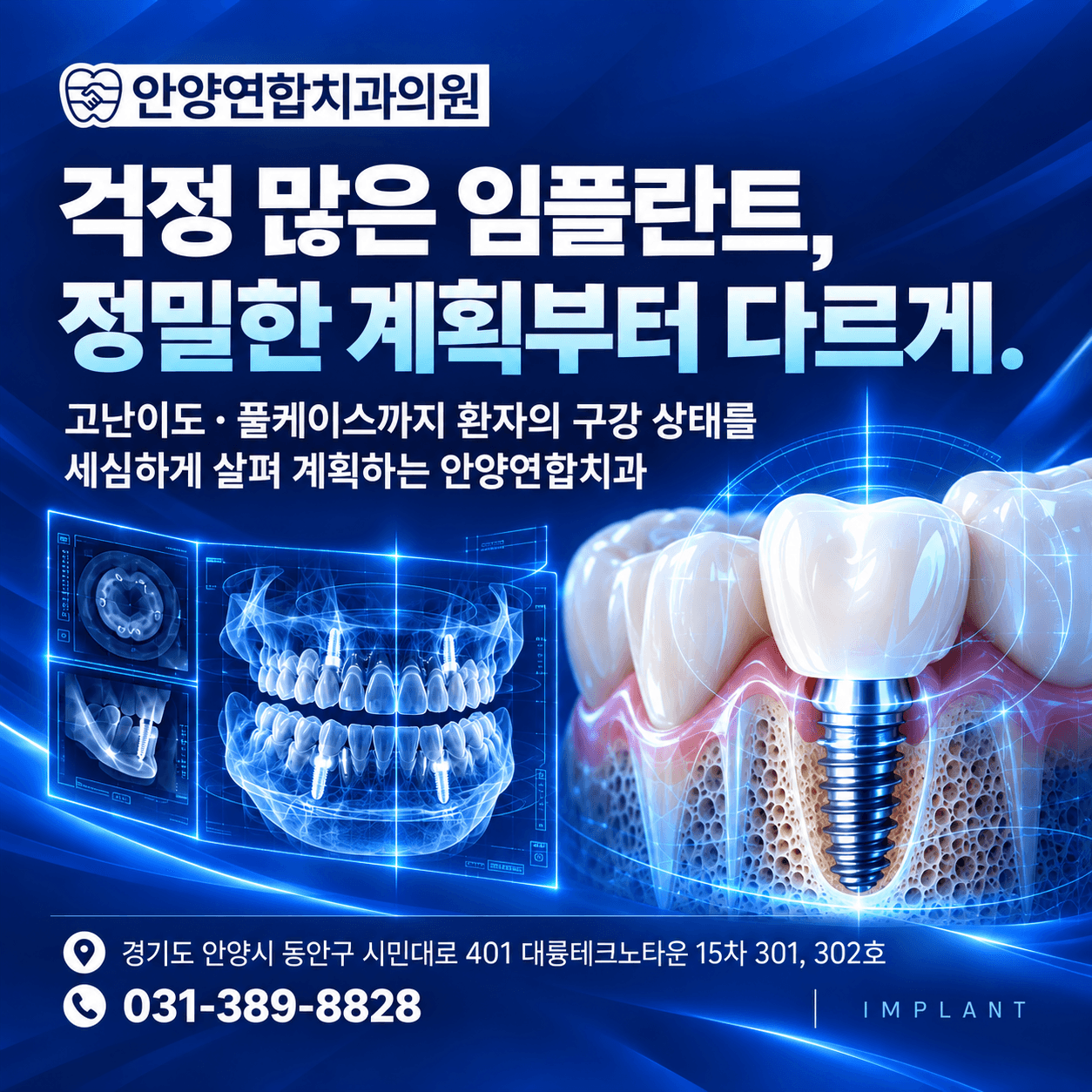 임플란트