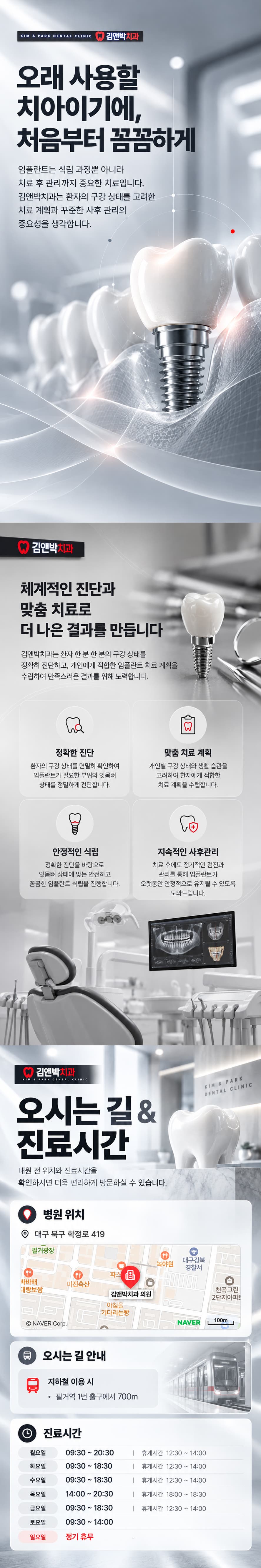 임플란트 상세 이미지